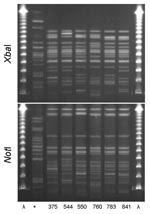 Thumbnail of XbaI and NotI pulsed-field gel electrophoresis patterns for clonal group I Escherichia coli isolated from women with urinary tract infections in Montréal, Québec, Canada, 2006. The 6 isolates shown were resistant to ciprofloxacin and in serogroup O25:H4. First and last lanes, bacteriophage λ; lane +, positive control.