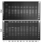 Thumbnail of XbaI and NotI pulsed-field gel electrophoresis patterns for clonal group C Escherichia coli isolated from women with urinary tract infections in Montréal, Québec, Canada, 2006 (lanes 304, 439, 362, 363, and 414) and Berkeley, California, USA, 1999–2001 (lanes 410, 316, 458, 1688, and 1996). The 10 isolates shown were susceptible to all antimicrobial drugs tested and included serogroups O1, O2, or O18. First and last lanes, bacteriophage λ; lane +, positive control.