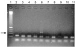 Thumbnail of PCR amplification of a 134-bp fragment of ancient DNA of Plasmodium falciparum in Egyptian mummies. Lane 1, molecular marker; lanes 10 and 11, 2 negative controls. One (lane 6) of 8 samples shows a positive amplification product (arrow). Specificity of the product was verified by sequencing.