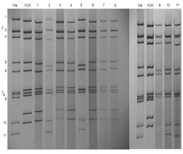Polyacrylamide gel electrophoresis and silver staining of rotavirus double-stranded RNA of representative serotype G12 strains from Lilongwe, Malawi. RNA segments are indicated to the left. Strains Wa (long electropherotype) and KUN (short electropherotype) are controls. Field strains, designated electropherotype profiles, and P types are as follows: Lane 1, KCH958 short – profile S1, P[6]; lane 2, KCH1120, long – profile L1, P[6]; lane 3, KCH1124, short – profile S1, P[6]; lane 4, KCH1050, shor