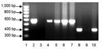 Thumbnail of PCR typing of Francisella tularensis, clades A1 and A2, in dessicated lagomorph carcasses. Lane 1, 100-bp ladder (Bio-Rad, Hercules, CA, USA); lane 2, A1 positive control (Schu S4); lane 3, A1 negative control (NM99); lane 4, UT07–5156 (A1); lane 5, UT07–5152 (A1); lane 6, UT07–5157 (A1), lane 7, UT07–5159 (A1), lane 8, A2 positive control (NM99); lane 9, A2 negative control (Schu S4); lane 10, UT07–5161 (A2).