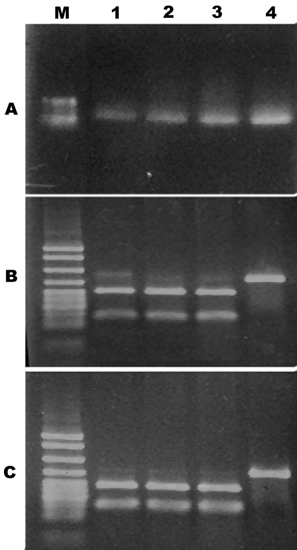 Figure 1&nbsp;-&nbsp;PCR restriction fragment length polymorphism of Vibrio vulnificus cytotoxin gene vvhA. A) PCR amplicon of vvhA gene restriction digested with B) PstI or C) KpnI. Gel shows molecular size standards (M) and V. vulnificus biotype 3 (lanes 1–3) and biotype 1 (lane 4).