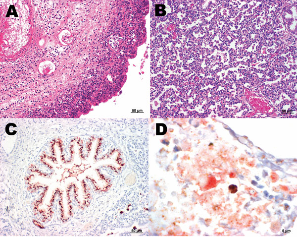 A) Sheep placenta positive by real-time PCR and immunohistochemistry for Parachlamydia spp. and Chlamydiaceae. Chlamydophila abortus was identified by ArrayTube Microarray. Necrotizing placentitis and vasculitis are shown (hematoxylin and eosin stain; magnification ×200). B) Fetal lung of the sheep abortion specimen positive by real-time PCR and immunohistochemical tests for Parachlamydia spp. and Chlamydiaceae; interstitial pneumonia is shown (hematoxylin and eosin stain; magnification ×200). C) Fetal lung that was positive by real-time PCR and immunohistochemical testing for Parachlamydia spp. Positive granular material can be seen within the lung tissue. Antigen detection (immunohistochemistry) was carried out with a polyclonal antibody directed against Parachlamydia spp. 3-amino-9-ethylcarbazole/peroxidase method (hematoxylin counterstain; magnification ×200). D) Double immunohistochemical labeling of the sheep placenta that was positive by real-time PCR and immunohistochemical tests for Chlamydiaceae and Parachlamydia spp. The simultaneous presence of Chlamydiaceae and Parachlamydia spp. granular reaction is shown within necrotic trophoblastic epithelium and neutrophilic exudate (diaminobenzidine/AEC/peroxidase method, hematoxylin counterstain; magnification ×1,000).