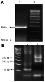 Thumbnail of Agarose gel electrophoresis showing chikungunya virus (A) and dengue virus (B) PCR products. A) Lane 1, 294-bp product specific for chikungunya virus; lane 2, 100-bp DNA marker. B) Lane 1, 100-bp DNA marker; lane 2, 119-bp product specific for dengue 2 virus; lane 3, 290-bp product for dengue 3 virus and 392-bp product for dengue 4 virus.
