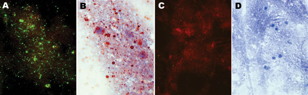 Detection of rabies virus antigen in brain impressions of the patient by direct fluorescent antibody test counterstained with Evans blue, 200× total magnification: A) positive control; B) negative control. Direct rapid immunohistochemistry test counterstained with hematoxylin, 400× total magnification: C) positive control; D) negative control.