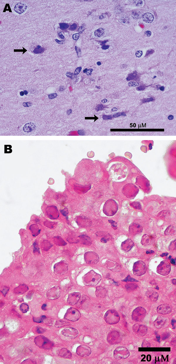 Photomicrographs showing A) encephalitis with neuronal necrosis and intranuclear inclusions (arrows) in a polar bear (Ursus maritimus); scale bar = 50 μm; hematoxylin and eosin stain; and B) Grevy’s zebra (Equus grevysi) with acute rhinitis with eosinophilic inclusions in respiratory epithelium; scale bar = 20 μm; hematoxylin and eosin stain.