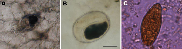 A) Metacercaria of Opisthorchis felineus in muscles of a tench (Tinca tinca) from Lake Bolsena (Latium region, central Italy). Scale bar = 100 μm. B) Metacercaria of O. felineus collected from a tench filet by digestion with 1% pepsin and 1% HCl. Scale bar = 100 μm. C) Egg detected in feces of the index patient of the August 2007 outbreak. Scale bar = 10 μm.