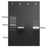 Thumbnail of PCR results for detection of a Mycoplasma haemofelis–like organism in an HIV-positive patient. Lane 1, 100-bp marker; lane 2, positive control (DNA from blood of an M. haemofelis–positive cat); lane 3, negative control (water); lane 4, DNA from blood of the patient.