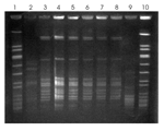 Thumbnail of Results of pulsed-field gel electrophoresis (PFGE) of Sphingomonas paucimobilis isolates obtained in November 2007. Lanes 1 and 10, molecular weight marker; lanes 2–7, bloodstream isolates from patients 1–6, respectively; lane 8, isolate from contaminated fentanyl; lane 9, unrelated control isolate. Patients 2 through 6 received intravenous fentanyl within 48 hours before S. paucimobilis bacteremia developed and had isolates with a PFGE pattern indistinguishable from that of fentany
