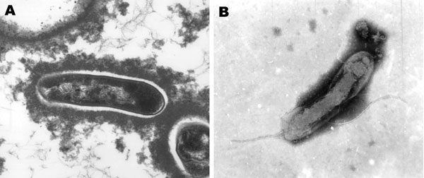 Transmission electron micrographs of Candidatus Bartonella melophagi–like isolate 05-HO-1 from a human (A) (image provided by the North Carolina State University–College of Veterinary Medicine Electron Microscopy Facility, Raleigh, NC, USA) and Candidatus B. melophagi isolate from a sheep ked (B) (image provided by V. Popov, University of Texas Medical Branch, Galveston, TX, USA). Magnification ×41,000 in A and ×62,700 in B.