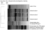 Thumbnail of DNA enterobacterial repetitive intergenic consensus PCR (eric) analysis of rapidly growing mycobacteria isolated from 3 patients in a mesotherapy-associated outbreak, January–February, 2007, Buenos Aires city, Argentina, compared with profiles of epidemiologically unrelated clinical isolates of the Mycobacterium abscessus–M. chelonae group. The dendrogram was constructed with the aid of BioNumerics software v 4.6 (Applied Maths, Sint-Martens-Latem, Belgium), using Dice unweighted pa