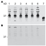 Thumbnail of Proteinase K–sensitive prion protein (PrPsen) Western blot analysis from 6 hamster species performed with A) polyclonal antibody R30 (89–103) or B) R30 preincubated with peptide to prion protein 89–103. Hamster species: lane 1, Syrian; lane 2, Turkish; lane 3, Djungarian; lane 4, Syrian; lane 5, Chinese; lane 6, Armenian. Lane 7, proteinase K–resistant prion protein (PrPres) from 263K Syrian hamsters. 0.8 mg tissue equivalents per lane; 37 kDa indicated.