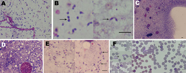 Microscopic appearance of Babesia sp. EU1 sporozoites isolated from tick salivary glands and of subsequent asexual development in erythrocytes. Sporozoites were stained with Giemsa and observed in the suspension of crushed salivary glands (A, B) and from salivary glands directly crushed between slides (C, D, E). Arrows indicate sporozoite dividing forms. A composite panel of asexual stages cultivated in sheep erythrocytes from these sporozoites is presented (F); developmental stages are indicate
