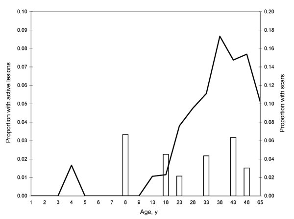 Age prevalence curve of persons with lesions (white bars) and scars (black line) from cutaneous leishmaniasis, Bolivia, 2007.