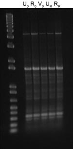 Thumbnail of Enterobacterial repetitive intergenic consensus typing of extended-spectrum β-lactamase–producing Escherichia coli isolated from index (0) and recurring (R) urine (U), rectal (R), and vaginal (V) samples from a nonpregnant young woman.