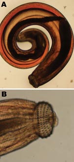 Thumbnail of Third-stage larva of Gnathostoma spinigerum, which was expressed from the face of a male British tourist who had visited Botswana. Photograph shows entire larva (A) and larva head with hooks (B).