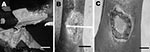 Thumbnail of Patient 1: extensive ulcer of the right limb (A). Patient 2: ulcer of the left ankle before treatment (B) and 8 weeks after specific antimicrobial drug therapy (C). Scale bars = 12 cm (A), 5 cm (B), and 2 cm (C).