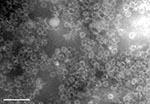 Thumbnail of Recombinant human bocavirus virus protein 2 virus-like particles. Scale bar = 100 nm.
