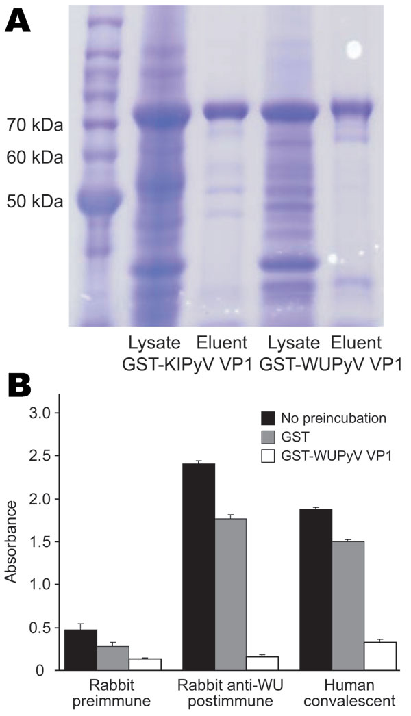 ELISA using WU polyomavirus (WUPyV) viral protein 1 (VP1) or KI polyomavirus (KIPyV) VP1 as the target antigen. A) Coomassie blue staining of a sodium dodecyl sulfate–polyacrylamide gel that contains bacterially expressed glutathione S-transferase (GST)–KIPyV VP1 and GST–WUPyV VP1 before and after glutathione-affinity purification. B) ELISA using rabbit hyperimmune serum and human WU polyomavirus convalescent-phase serum preincubated with buffer alone, GST protein, or GST–WUPyV VP1. Error bars indicate mean and SD.