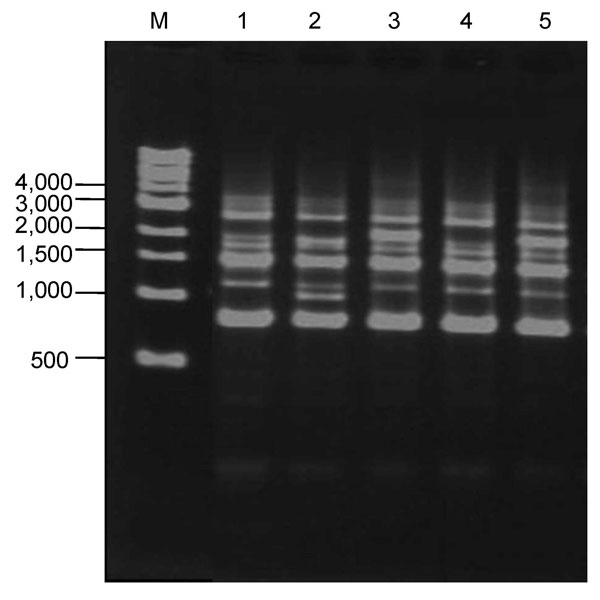 Repetitive-element PCR DNA fingerprints of Legionella pneumophila serogroup 1 isolates (lanes 1–5) from the same puddle of rainwater on an asphalt road in Tokyo, Japan. Lane M shows DNA reference marker sizes (New England BioLabs, Inc., Ipswich, MA, USA) in basepairs.