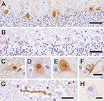 Thumbnail of Avian bornavirus protein demonstrated by immunohistochemical testing in the central nervous system of birds with proventricular dilatation disease (PDD). A) within nuclei, cytoplasm and dendrites of several Purkinje cells of the cerebellum, bar = 50 µm; B) negative control: no immunoreactivity of Purkinje cells in a PDD-negative bird, bar = 50 µm; C–F), different phenotypes of positive neurons: C) within neurons, viral protein is expressed within intranuclear inclusion bodies; D) di