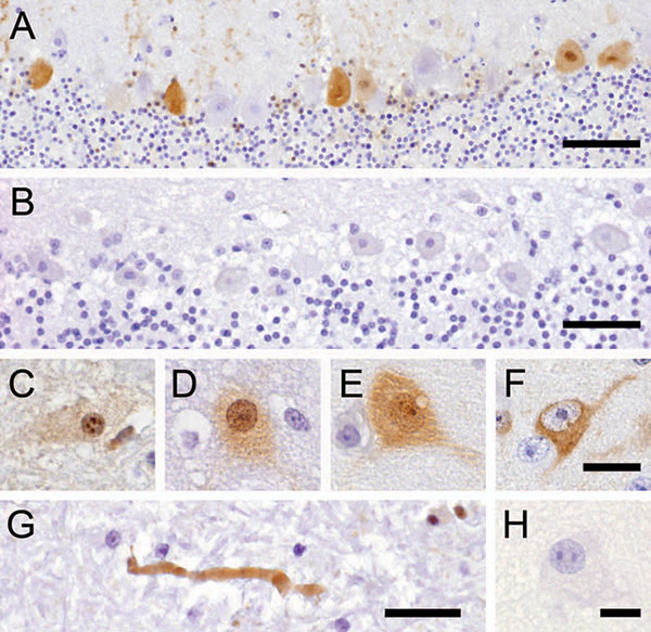 Avian bornavirus protein demonstrated by immunohistochemical testing in the central nervous system of birds with proventricular dilatation disease (PDD). A) within nuclei, cytoplasm and dendrites of several Purkinje cells of the cerebellum, bar = 50 µm; B) negative control: no immunoreactivity of Purkinje cells in a PDD-negative bird, bar = 50 µm; C–F), different phenotypes of positive neurons: C) within neurons, viral protein is expressed within intranuclear inclusion bodies; D) diffusely withi