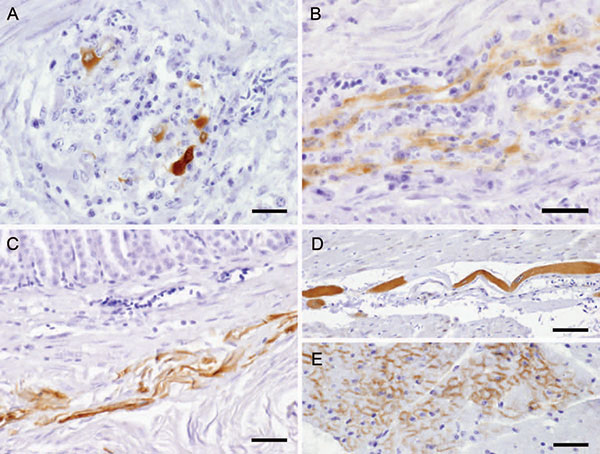 Avian bornavirus protein demonstrated by immunohistochemical testing in extracerebral locations. A) within neurons of proventricular intramural vegetative ganglia with inflammatory infiltration, bar = 25 µm; B) within nerve fibers of the myenteric plexus of gizzard, bar = 25 µm; C) within smooth muscle fibers of the proventricular wall, bar = 50 µm; D) within a modified muscle fiber of the conductive system of the heart, bar = 50 µm; E) within myocardiocytes, bar = 25 µm.