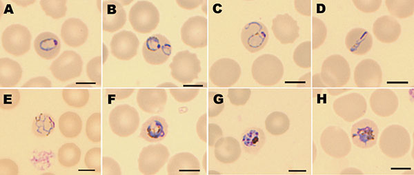 Morphology of Plasmodium knowlesi in a Giemsa-stained thin blood smear. Infected erythrocytes were not enlarged, lacked Schuffner stippling, and contained much pigment. Shown are examples of trophozoites (A–F), a schizont (G), and a gametocyte (H). Scale bars = 5 μm.