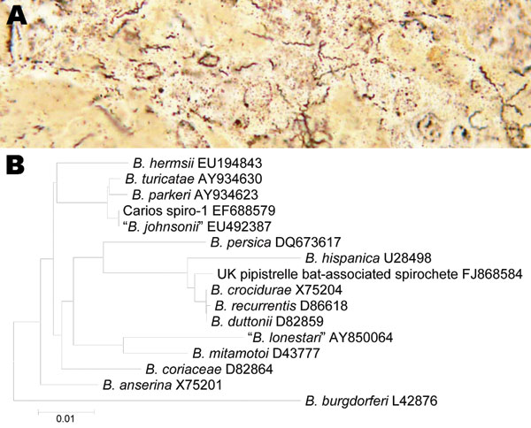 A) Warthin-Starry–stained section of bat liver showing numerous spirochetes. B) Phylogram inferred from 776-bp alignment of flaB fragments obtained from infected bat liver tissue and for other members of the relapsing fever group of Borrelia species for which sequence data were available. B. burgdorferi is included as an outgroup. The numbers appearing after the names of the Borrelia species are the relevant GenBank accession numbers. Scale bar indicates nucleotides substitutions per site.