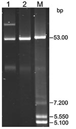 Thumbnail of Plasmids isolated from Salmonella enterica serovar Typhi and Escherichia coli J53 transconjugant. Lane 1, S. enterica ser. Typhi 218/08 (blaCTX-M-15 + blaTEM-1 + qnrB2); lane 2, E. coli J53 transconjugant (blaCTX-M-15 + qnrB2); lane M, plasmid marker E. coli V517.