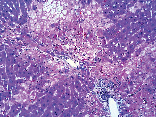 Multifocal periportal and midzonal heptic necrosis in affected rabbit. Hematoxylin and eosin stain. Original magnification ×200.