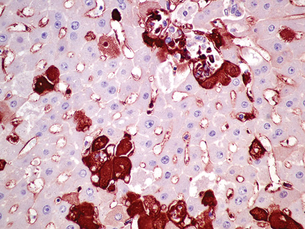 Liver of affected rabbit with positive cytoplasmic immunohistochemical labeling in hepatocytes against rabbit hemorrhagic disease virus capsid. Original magnification ×400.