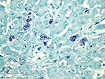 Thumbnail of Liver of affected rabbit showing in situ hybridization of a Michigan rabbit calicivirus-specific oligonucleotide probe within scattered hepatocytes. Original magnification ×400.