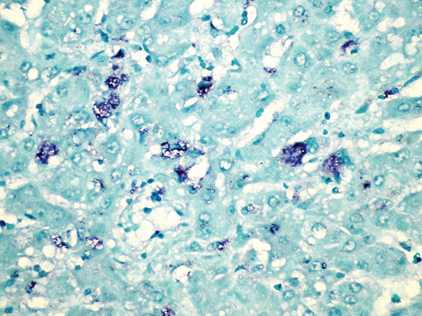 Liver of affected rabbit showing in situ hybridization of a Michigan rabbit calicivirus-specific oligonucleotide probe within scattered hepatocytes. Original magnification ×400.