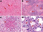 Thumbnail of Photomicrographs of liver, spleen, and lung sections from influenza virus A (H5N1)–infected mice at endpoint. Necrotic foci (arrows) scattered throughout the liver (A) (original magnification ×200) and spleen (B) (original magnification ×100) from subtype H5N1–infected mice (hematoxylin and eosin stain); these foci are absent from subtype H1N1–infected mouse livers. C) Necrotic foci in the liver stain periodic acid–Schiff (PAS)–positive (arrow), which suggests focal accumulation of