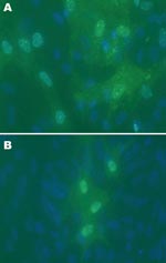 Thumbnail of A) Avian bornavirus (ABV)–infected duck embryonic fibroblast (DEF) cell culture 6 days after injection with hindbrain tissues from an African gray parrot with confirmed proventricular dilatation disease (AG5) and staining by an indirect immunofluorescence assay for ABV N-protein. Speckled immunofluorescence is typical of bornavirus infection. Original magnification ×40. B) DEFs 3 days after injection with forebrain from a yellow-collared macaw with confirmed proventricular dilatatio