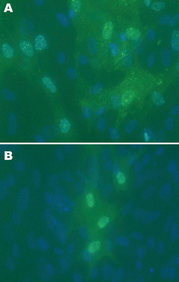A) Avian bornavirus (ABV)–infected duck embryonic fibroblast (DEF) cell culture 6 days after injection with hindbrain tissues from an African gray parrot with confirmed proventricular dilatation disease (AG5) and staining by an indirect immunofluorescence assay for ABV N-protein. Speckled immunofluorescence is typical of bornavirus infection. Original magnification ×40. B) DEFs 3 days after injection with forebrain from a yellow-collared macaw with confirmed proventricular dilatation disease (M2