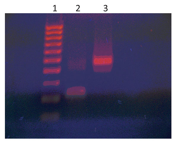 HaeIII digestion of adenovirus 36 (Adv 36) DNA PCR products of the patient. Lane 1, molecular size marker; lane 2, HaeIII digest of Adv 36 DNA; lane 3, undigested Adv 36 DNA.