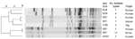 Thumbnail of Dendrogram of ApaI–pulsed-field gel electrophoresis of methicillin-resistant Staphylococcus aureus clonal complex 398. Scale bar indicates percentage similiarity.