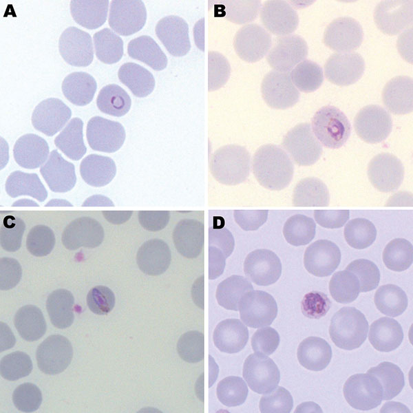 Giemsa-stained thin blood films of patient infected with Plasmodium knowlesi, showing a ring form (A), a trophozoite with Sinton and Mulligan stippling (B), a band form resembling P. malariae (C), and an early schizont (D). Original magnification ×100.