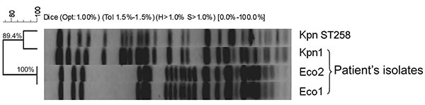 Pulsed-field gel electrophoresis demonstrating genetic relatedness of study isolates Eco2, Eco1, and Kpn1, and a representative Klebsiella pneumoniae isolate of the epidemic clone, Kpn ST258, Israel, 2008. Bacterial DNA was prepared and cleaved with 20U SpeI endonuclease (New England Biolabs, Beverly, MA, USA), followed by electrophoresis in a CHEF-DR III apparatus (Bio-Rad Laboratories, Inc., Hercules, CA, USA), as described (4). The macrorestriction patterns of the isolates were compared accor