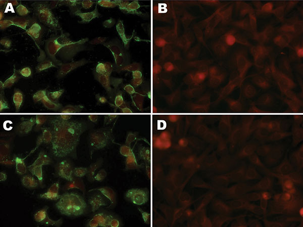 Slides showing immunofluorescence of A72 cells with human respiratory syncytial virus monoclonal antibodies (MAbs). A) MAb 2G122 on infected cells. B) MAb 2G122 on uninfected cells. C) MAb 5H5N on infected cells. D) MAb 5H5N on uninfected cells. Primary MAb stocks were used as obtained from the manufacturer at a dilution of 1:100. The red background is produced by counterstaining with Evans blue dye. Original magnification ×200.