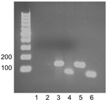Thumbnail of Detection of Granulibacter sp. DNA by PCR of the spleen of a patient with chronic granulomatous disease. Lanes 1 and 2, no template controls for each primer set; lane 3, 400 ng of spleen DNA amplifying Granulibacter sp. 16S rRNA gene; lane 4, 400 ng of spleen DNA amplifying the Granulibacter sp. methanol dehydrogenase gene; lane 5, 100 ng DNA from the G. bethesdensis type strain amplifying the 16S rRNA gene (positive control); lane 6, 100 ng DNA from the G. bethesdensis type strain
