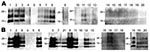 Thumbnail of Western blot analysis of a protease-resistant form (PrPres) of a normal cellular prion protein in nerve tissue samples obtained from cattle 10 (A) and 16 (B) months postinoculation (cattle identification codes 8515 and 1061, respectively). The nerve tissues tested are shown above the lanes: 1, trigeminal ganglia; 2, pituitary gland; 3, anterior cervical ganglion; 4, facial nerve; 5, hypoglossal nerve; 6, cranial mesenteric ganglia; 7, vagus nerve (cervical part); 8, stellate ganglia