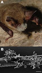 Thumbnail of A) Greater mouse-eared bat (Myotis myotis) with white fungal growth around its muzzle, ears, and wing membranes (photograph provided by Tamás Görföl). B) Scanning electron micrograph of a bat hair colonized by Geomyces destructans. Scale bar = 10 µm.