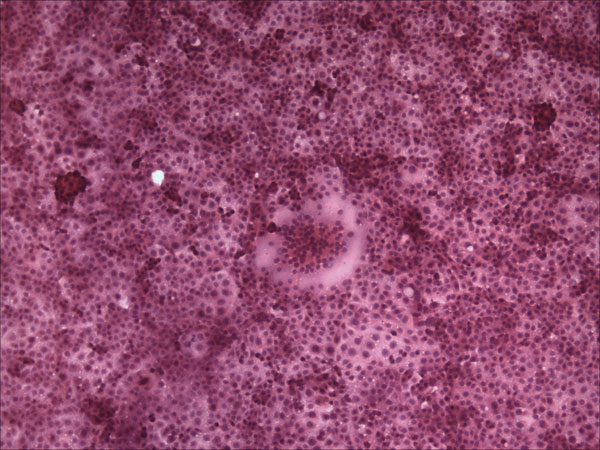 VeroDogSLAM cells 30 h postinfection inoculated with tissue (liver) homogenate from a dead adult female harbor seal from Maine that died in July 2006. Syncytia are seen in the monolayer, which is stained with hematoxylin and eosin (original magnification ×100).