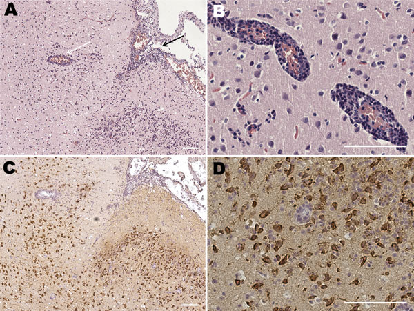 Microscopic lesions of brain caused by human herpesvirus 1 infection in marmosets. A) Histopathogic sample stained with hematoxylin and eosin showing nonsuppurative meningoencephalitis with perivascular infiltrates (black arrow) and infiltrates in piamater (white arrow). B) Histopathologic sample stained with hematoxylin and eosin showing perivascular and vascular infiltrates of mononuclear cells. C, D) Immunohistochemical examination by using polyclonal antibody directed against human herpesvir