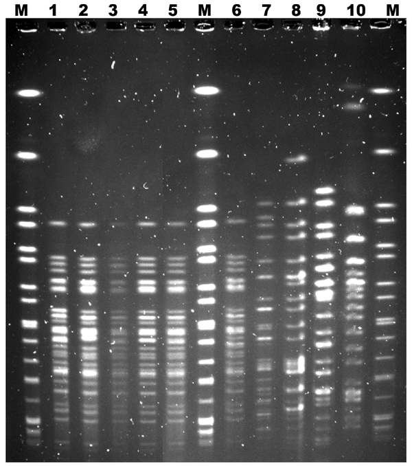 Representative XbaI pulsed-field gel electrophoresis patterns of Shiga toxin–producing Escherichia coli (STEC) O123:H– strains isolated from patient fecal samples and strains isolated from ground beef obtained from patients’ home, France, 2009. Lanes M, XbaI-digested genomic DNA from Salmonella enterica serovar Braenderup H9812 used as molecular mass markers; lane 1, Shiga toxin–producing STEC O123:H– isolated from patient with hemolytic uremic syndrome; lane 2, STEC O123:H– isolated from patien