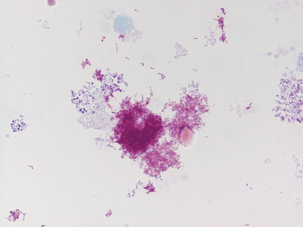 Gimenez stain of Bartonella henselae obtained by the culture in human embryonic lung of the skin biopsy of a patient with cat scratch disease, France, 2010. Original magnification ×100.