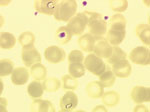 Thumbnail of Two trophozoites, pear-shaped, of Babesia divergens in erythrocytes from case-patient 1 (original magnification ×1,000, May-Grünwald-Giemsa stain).